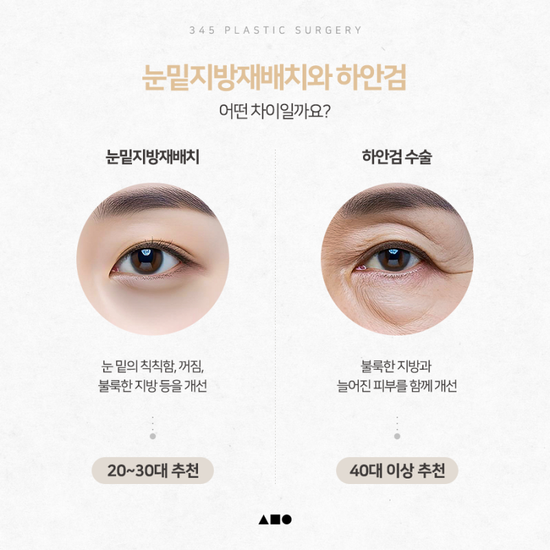 하안검 VS 눈밑지방재배치 어떻게 다를까요?