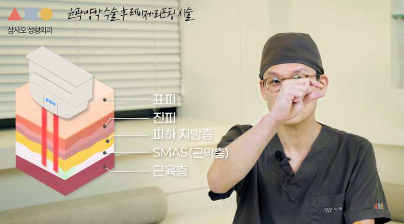 윤곽, 양악 수술 후 레이저 시술 받아도 되나요? 뼈박사가 알려드립니다