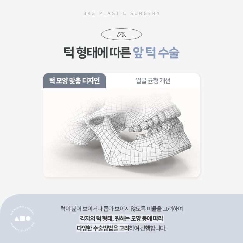 남자 안면윤곽 전후, 얼굴형에 맞는 수술 방법은? 사진 5