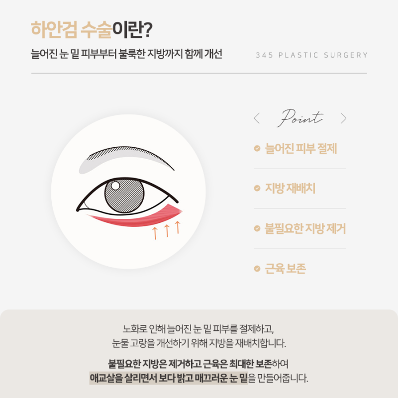 하안검 수술 잘하는 곳 찾을 때 확인해야 할 것은? 사진 2