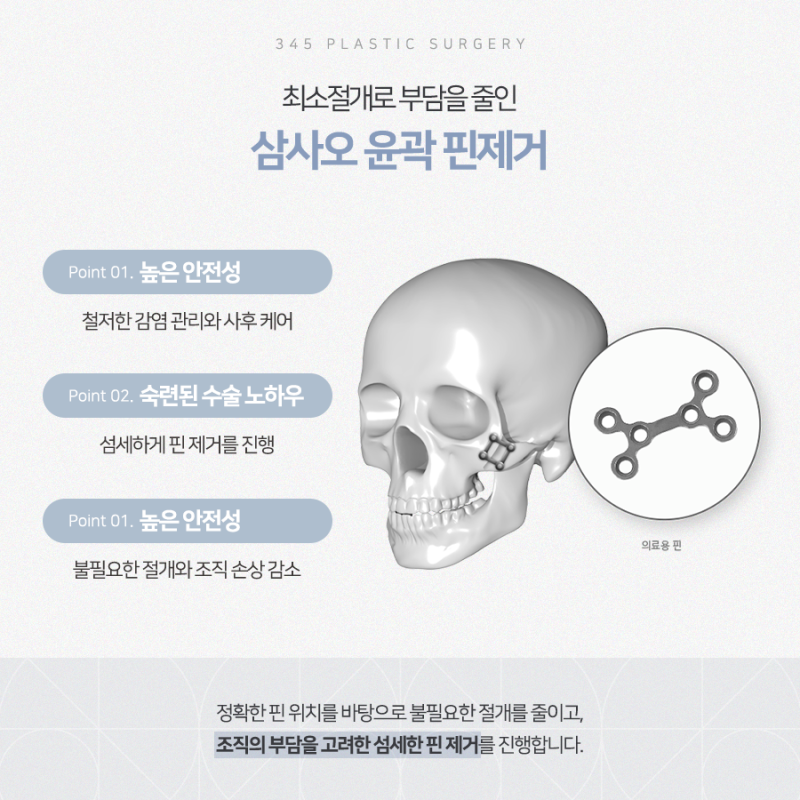 윤곽수술 핀제거, 이 기간 안에 하셔야 합니다 사진 3