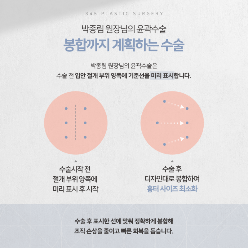 20대 여성 윤곽 2종 (광대, 사각턱) 리얼 붓기 변화 사진 6