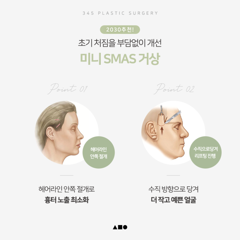 Mini Facelift vs. Minimal Incision Facelift vs. Full Facelift: Differences and Ideal Candidates 사진 4