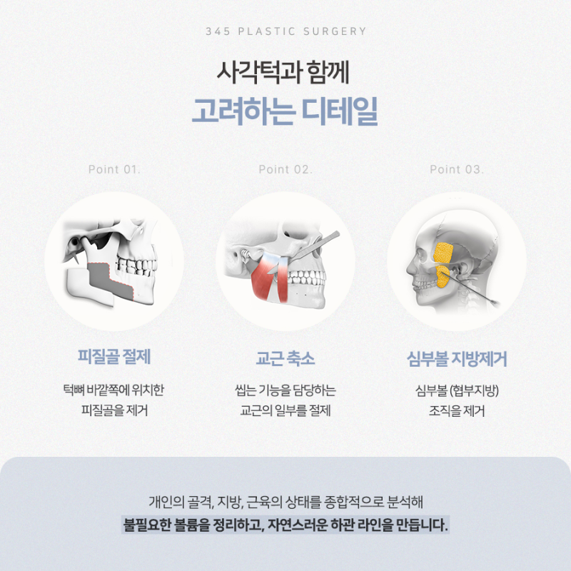 남자 사각턱수술, 갸름하기보다 자연스러운 턱선이 중요한 이유 사진 5