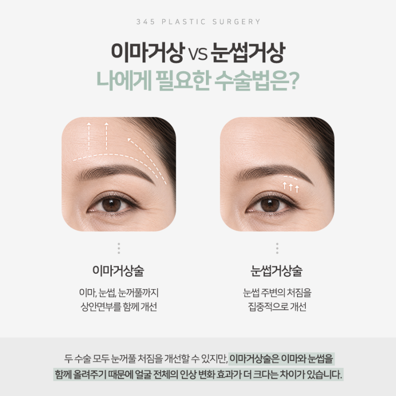 처진 눈썹과 무거워진 눈매, 어떤 수술이 필요할까요? 사진 4