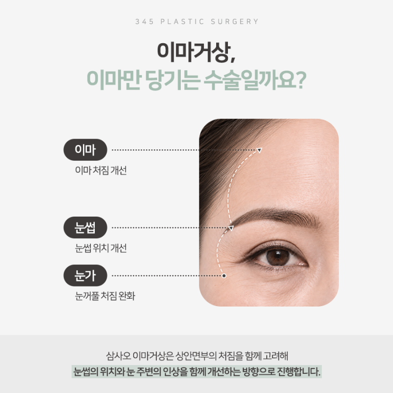 처진 눈썹과 무거워진 눈매, 어떤 수술이 필요할까요? 사진 3
