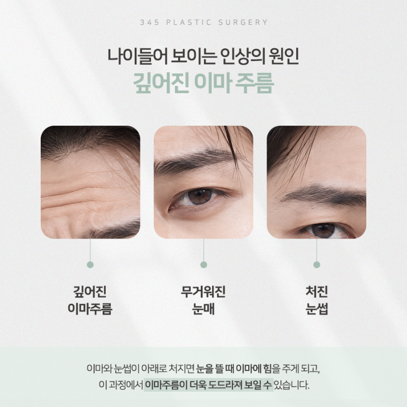 남자 이마주름, 자연스럽게 개선할 수 있을까?