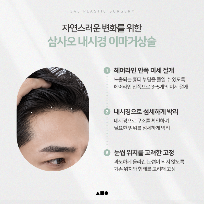 남자 이마주름, 자연스럽게 개선할 수 있을까? 사진 5
