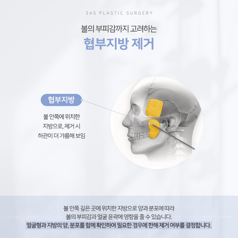 사각턱 수술, 뼈만 줄이면 될까요? 피질절골, 교근축소, 협부지방제거 사진 6