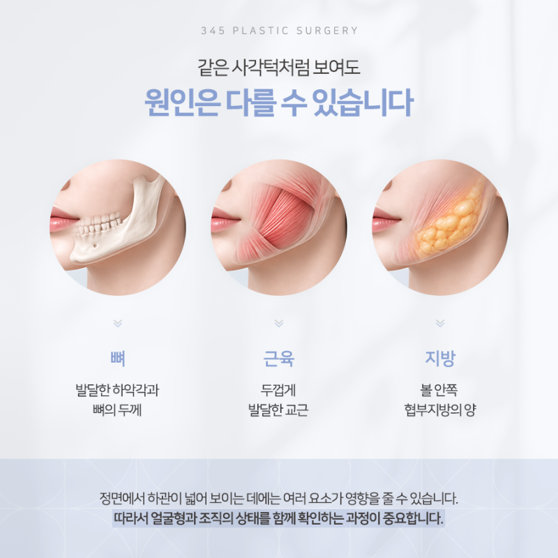 사각턱 수술, 뼈만 줄이면 될까요? 피질절골, 교근축소, 협부지방제거