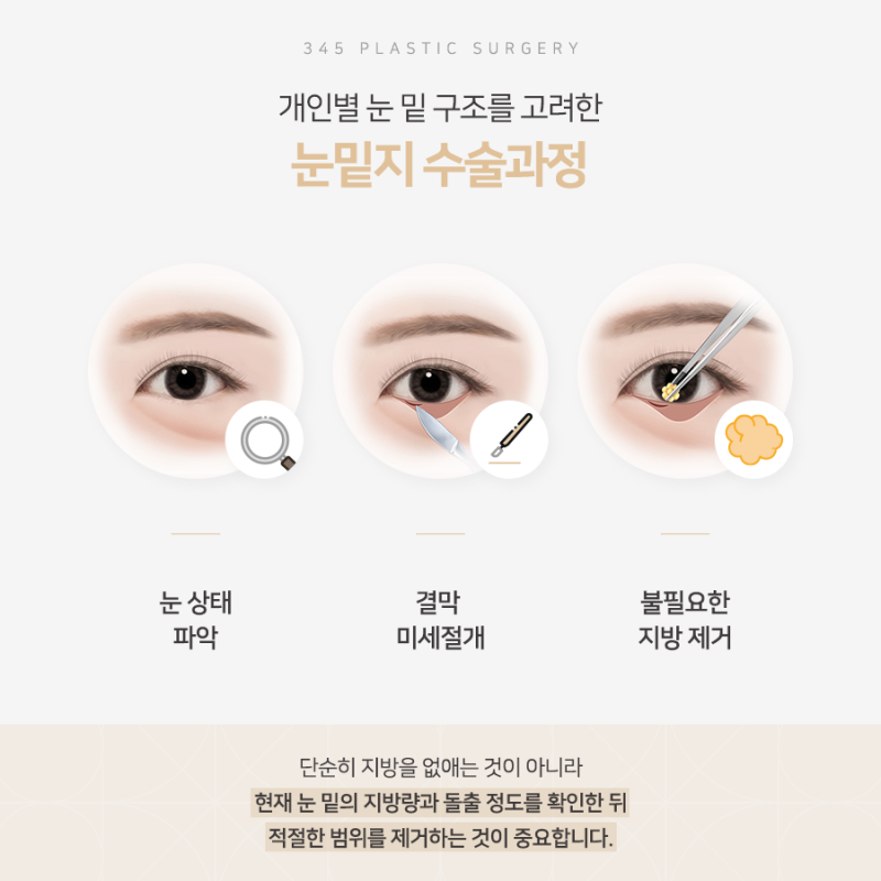 볼록한 눈 밑 지방, 어떻게 줄일 수 있을까요? 사진 3