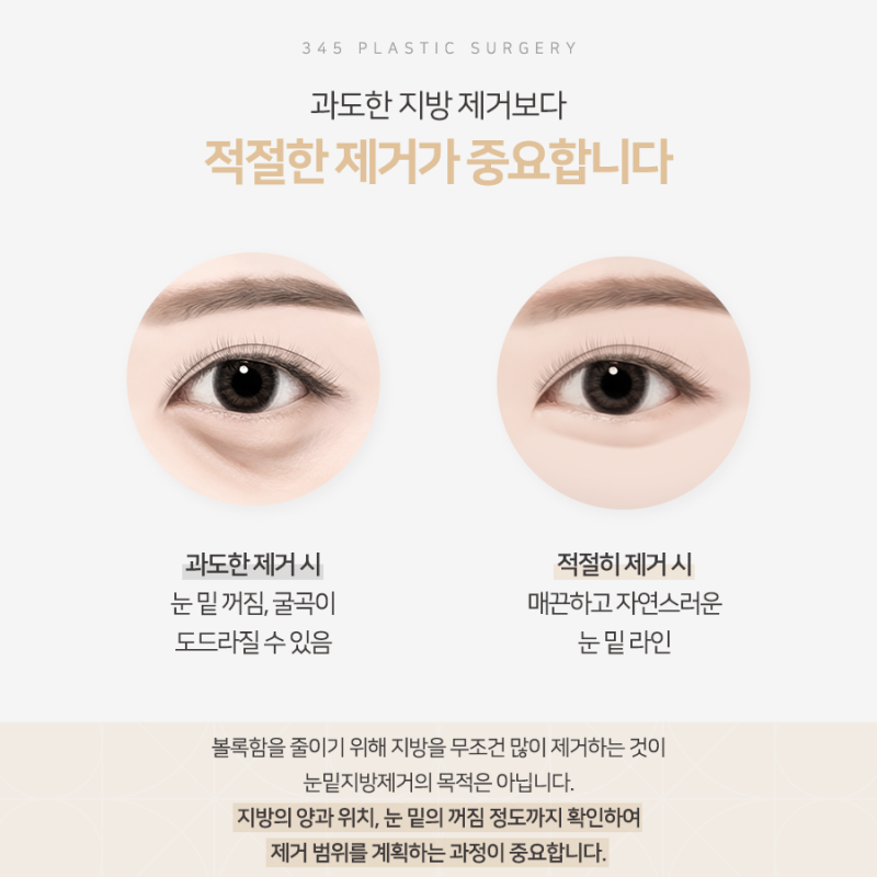 볼록한 눈 밑 지방, 어떻게 줄일 수 있을까요? 사진 4