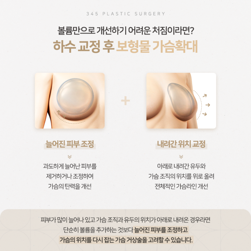 처진 가슴, 볼륨만 채우면 될까요? 삼사오 처진가슴리프팅 사진 4