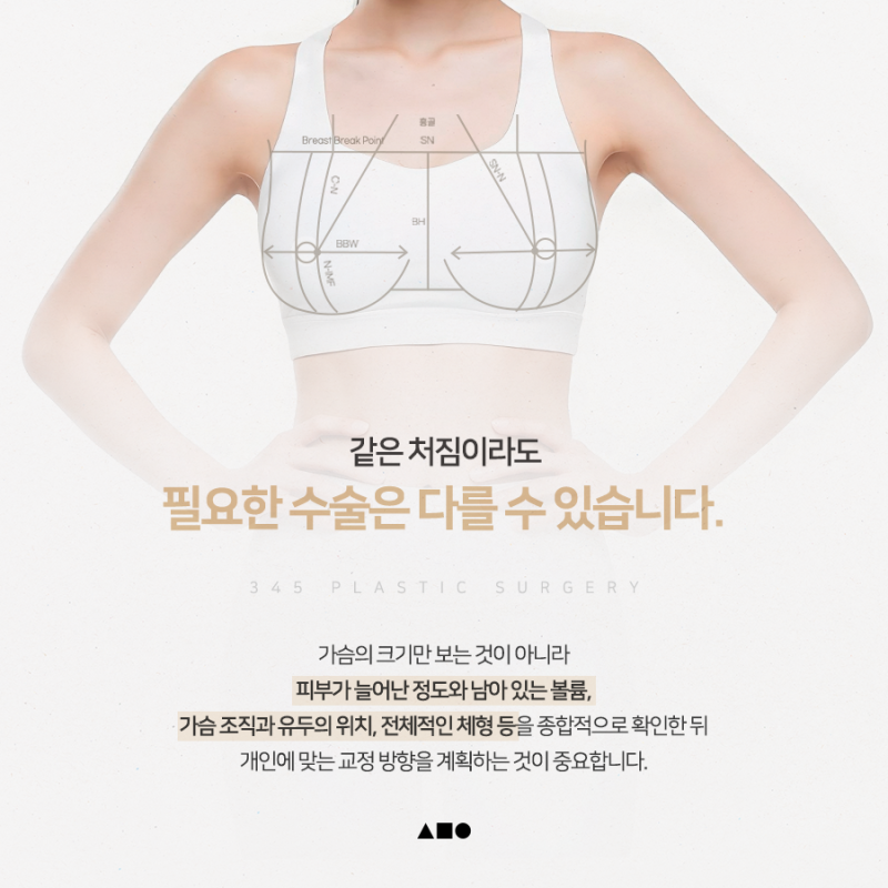 처진 가슴, 볼륨만 채우면 될까요? 삼사오 처진가슴리프팅 사진 6